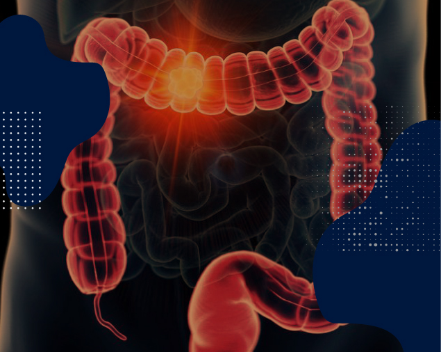 CONFERENCIA: CÁNCER DE COLON, ¿SE PUEDE PREVENIR?